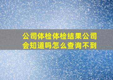 公司体检体检结果公司会知道吗怎么查询不到