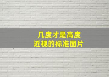 几度才是高度近视的标准图片