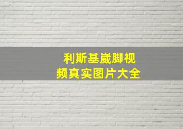 利斯基崴脚视频真实图片大全