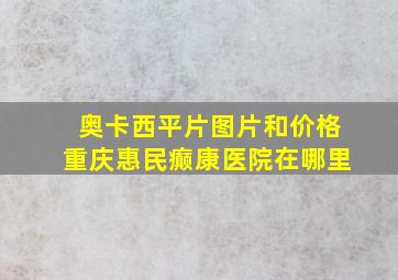 奥卡西平片图片和价格重庆惠民癫康医院在哪里