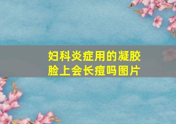 妇科炎症用的凝胶脸上会长痘吗图片