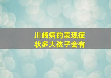 川崎病的表现症状多大孩子会有