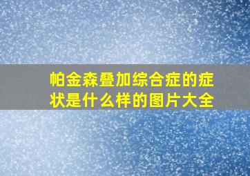 帕金森叠加综合症的症状是什么样的图片大全