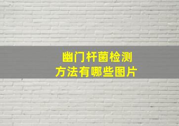 幽门杆菌检测方法有哪些图片