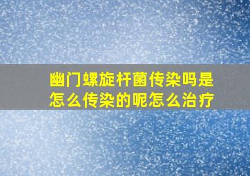 幽门螺旋杆菌传染吗是怎么传染的呢怎么治疗