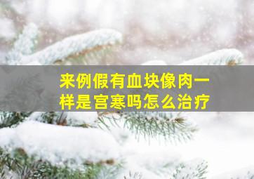 来例假有血块像肉一样是宫寒吗怎么治疗