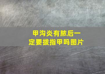 甲沟炎有脓后一定要拔指甲吗图片