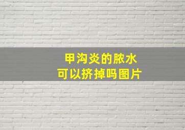 甲沟炎的脓水可以挤掉吗图片