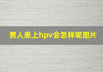 男人患上hpv会怎样呢图片