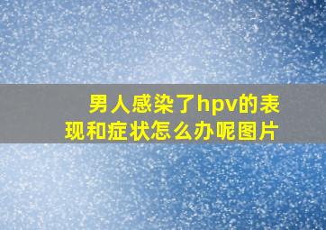 男人感染了hpv的表现和症状怎么办呢图片