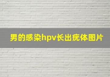 男的感染hpv长出疣体图片