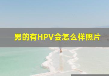 男的有HPV会怎么样照片