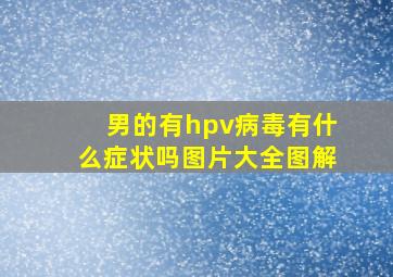 男的有hpv病毒有什么症状吗图片大全图解