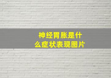 神经胃胀是什么症状表现图片