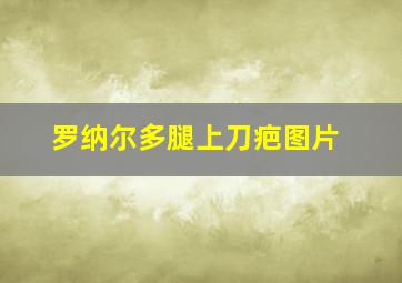 罗纳尔多腿上刀疤图片