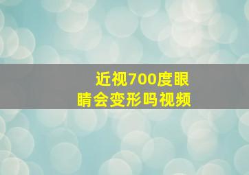 近视700度眼睛会变形吗视频