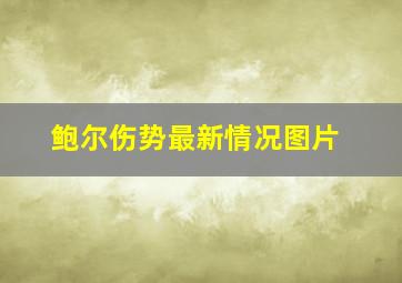 鲍尔伤势最新情况图片